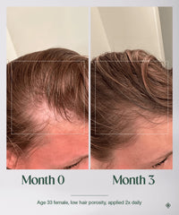 The Hair Multiplier