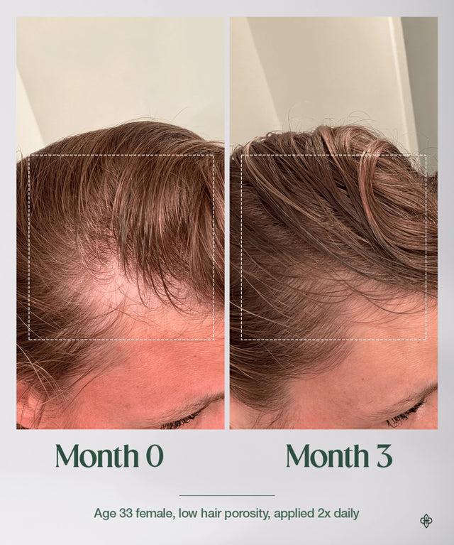 The Hair Multiplier